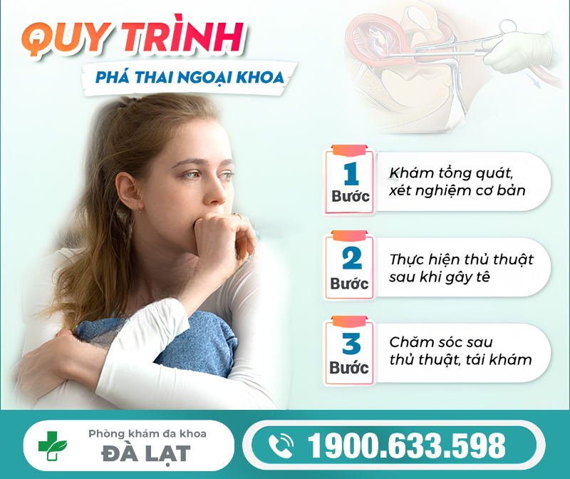 Hình ảnh minh họa